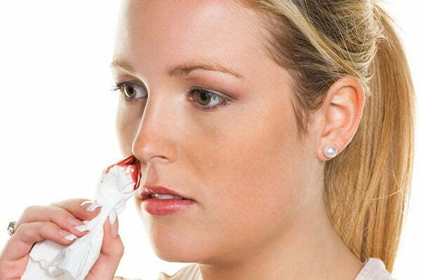 phòng tránh viêm xoang mũi ra máu 