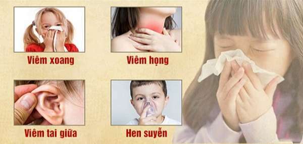 Biến chứng nguy hiểm của bệnh viêm xoang mũi trẻ em