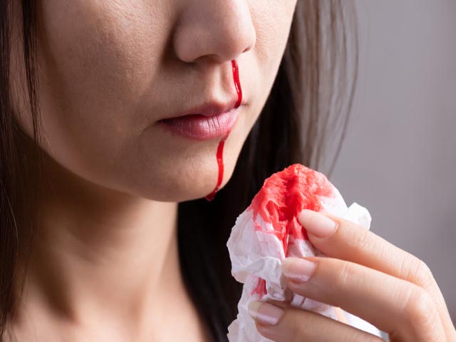 Mức độ nguy hiểm của tình trạng viêm mũi chảy máu 